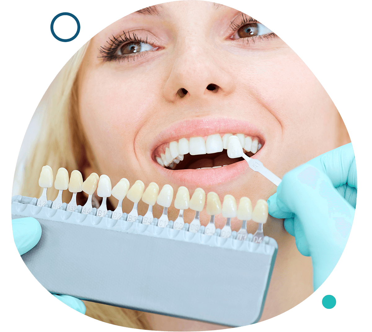 Teeth Checkups