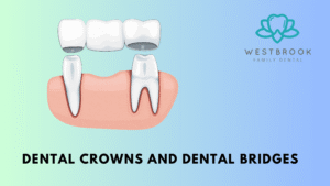 Dental Crowns and Dental Bridges