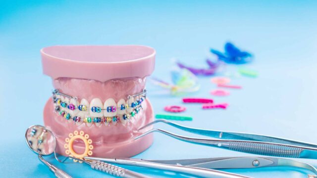 Orthodontic Care 