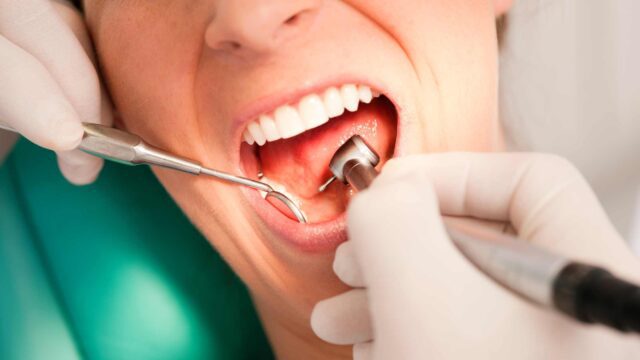 Dental Cleanings