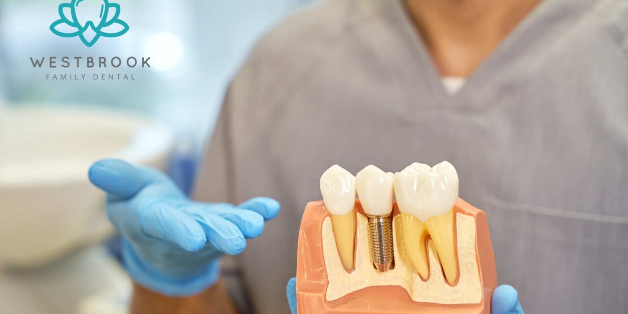 Why Tooth Implants? A Deep Dive into the Long-Term Value of Dental Implants