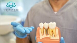Tooth Implants