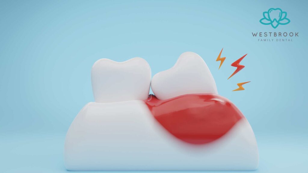 Gum Pain