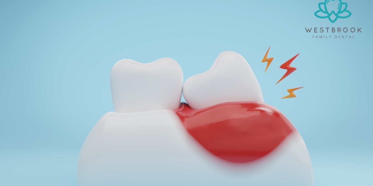 What Are the Early Warning Signs of Gum Pain You Shouldn’t Ignore?