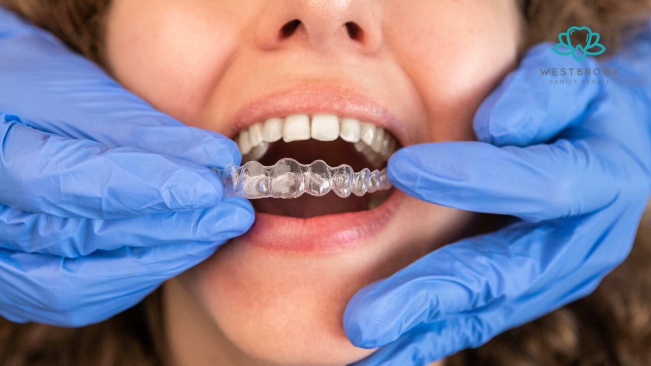 Invisalign