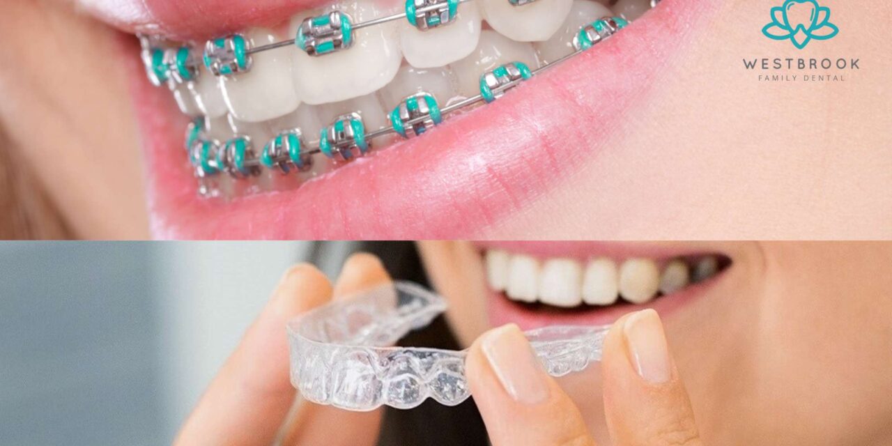 Can Braces, Invisalign Fix All Types of Teeth Misalignment?