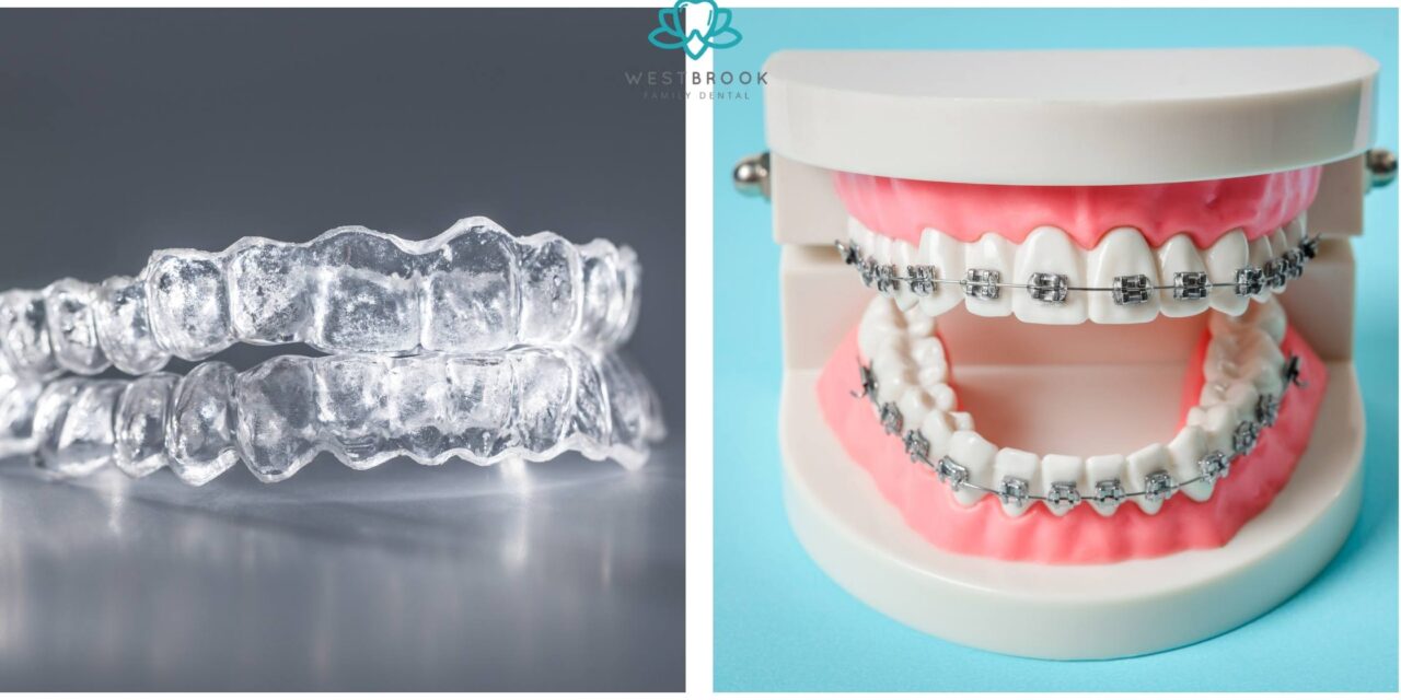 Teeth Braces Invisible vs. Traditional Braces: Which One is Right?