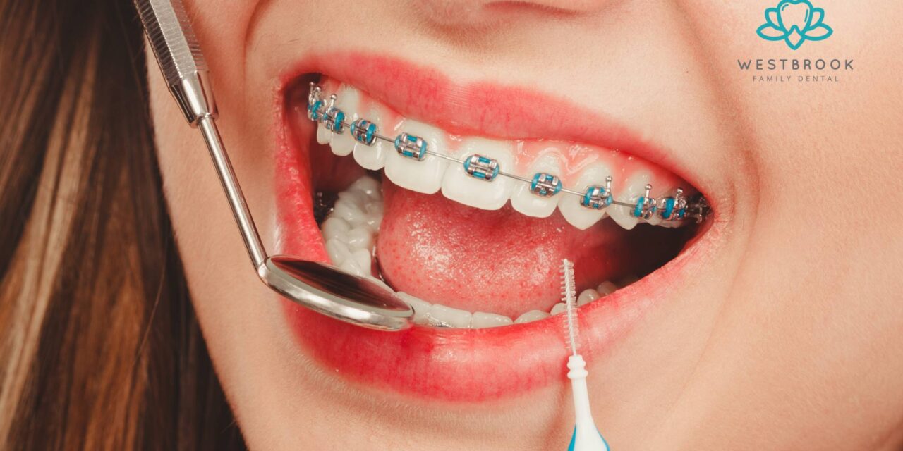 Are Teeth Braces for Adults Worth It? Pros and Cons Explained