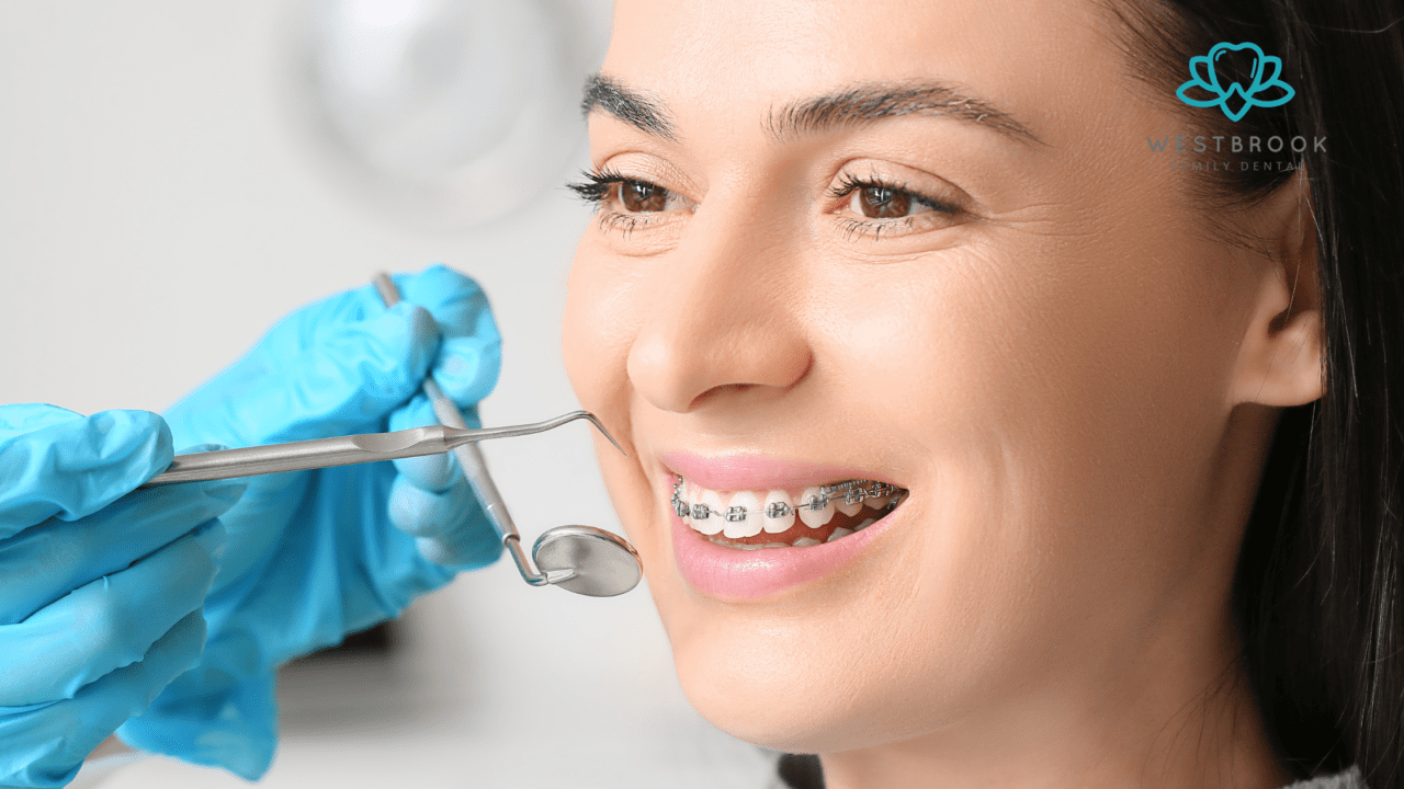 Teeth Braces