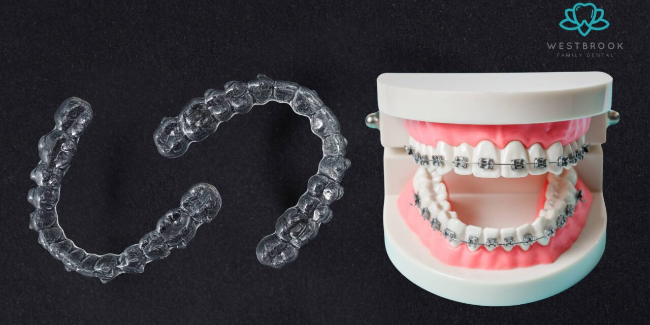 Is Invisalign on Teeth Better Than Braces? Here’s What You Need to Know