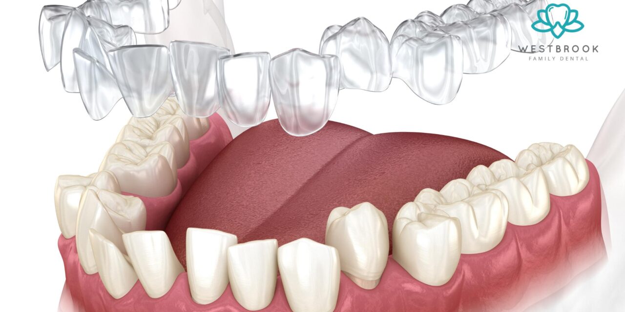5 Questions to Ask Before Choosing an Invisalign Dentist Near Me