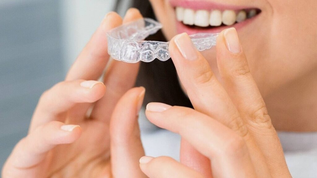 Invisalign on Teeth