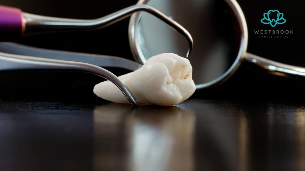 Wisdom Teeth Extraction