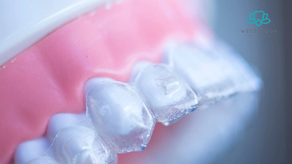 Invisalign on Teeth