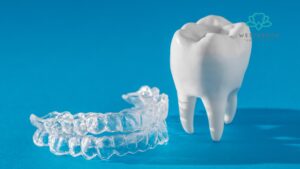 Invisalign Costs