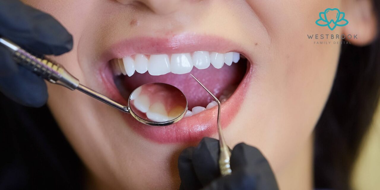 Cosmetic Dentistry 2.0 The Smile Trends Defining 2025 in Toowoomba