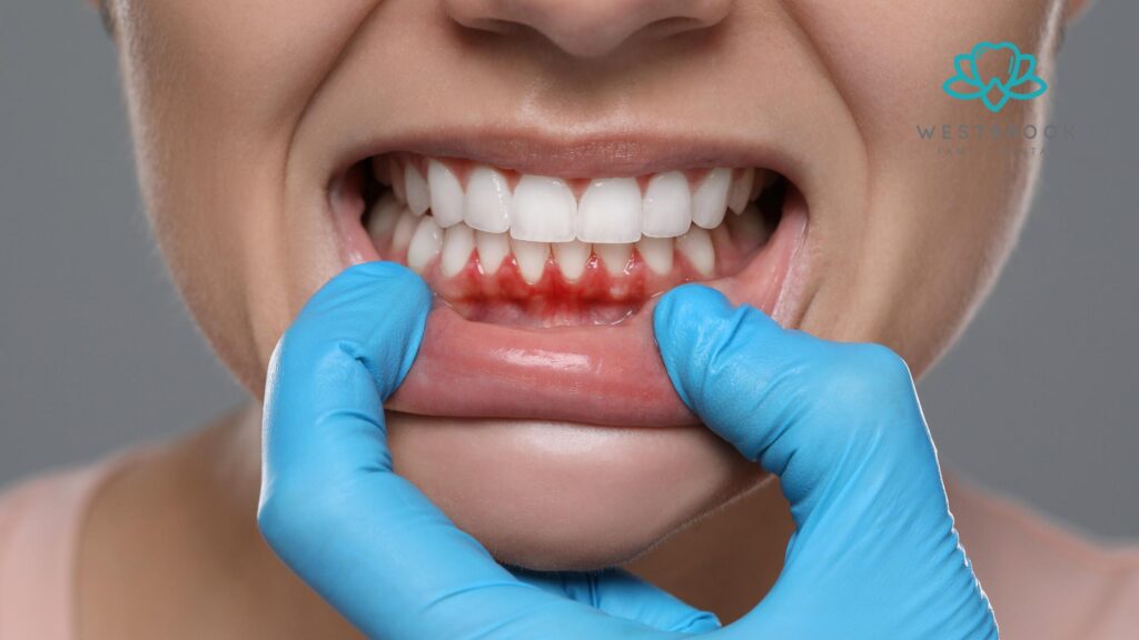 Preventing Gum Disease Early: Why Regular Dental Checkups Matter More Than You Think Westbrook Dental