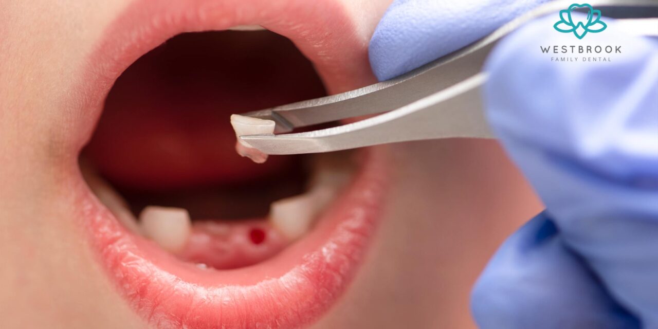 Knocked-Out Tooth in Toowoomba? How an Emergency Dentist Near Me Can Help Save It