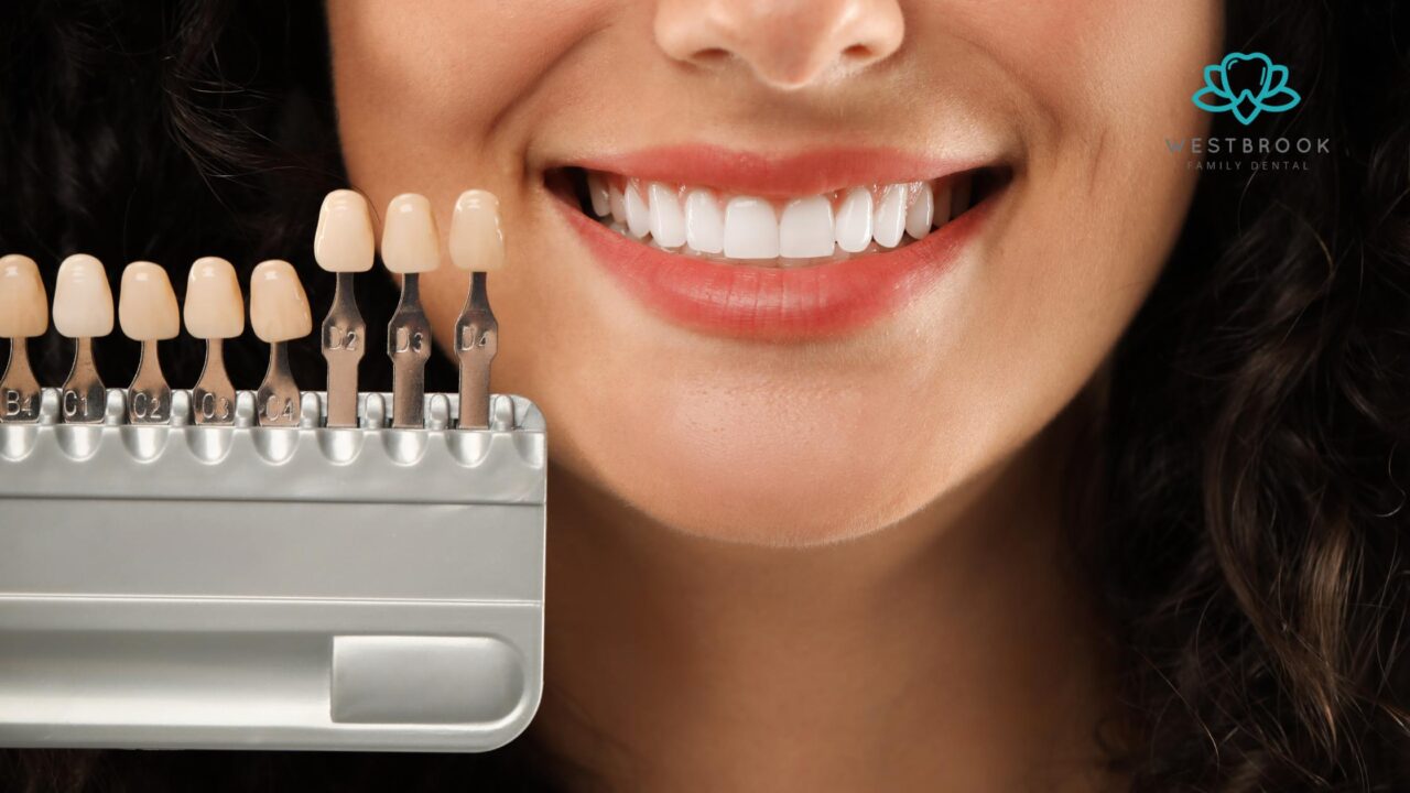 Benefits of Minimal-Prep Veneers